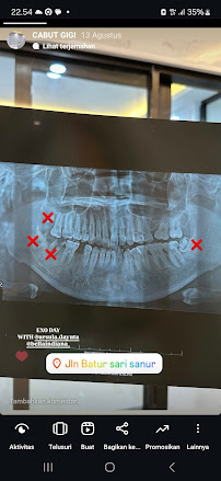 MYD DENTAL CLINIC BALI