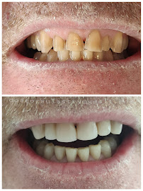 Smile by Sulastry