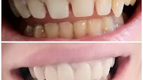 Smile by Sulastry