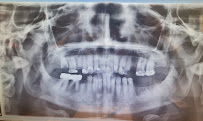 ÖZEL WESTDENT AĞIZ DİŞ HASTANESİ- Türkiye İzmir İmplant Diş Dent Clinic Türkey Dental İmplants in Turkey Zirconium in Turkey