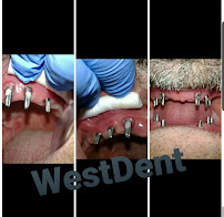 ÖZEL WESTDENT AĞIZ DİŞ HASTANESİ- Türkiye İzmir İmplant Diş Dent Clinic Türkey Dental İmplants in Turkey Zirconium in Turkey