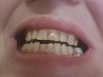 ÖZEL WESTDENT AĞIZ DİŞ HASTANESİ- Türkiye İzmir İmplant Diş Dent Clinic Türkey Dental İmplants in Turkey Zirconium in Turkey