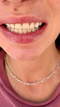 ÖZEL WESTDENT AĞIZ DİŞ HASTANESİ- Türkiye İzmir İmplant Diş Dent Clinic Türkey Dental İmplants in Turkey Zirconium in Turkey