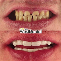 ÖZEL WESTDENT AĞIZ DİŞ HASTANESİ- Türkiye İzmir İmplant Diş Dent Clinic Türkey Dental İmplants in Turkey Zirconium in Turkey