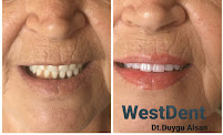 ÖZEL WESTDENT AĞIZ DİŞ HASTANESİ- Türkiye İzmir İmplant Diş Dent Clinic Türkey Dental İmplants in Turkey Zirconium in Turkey