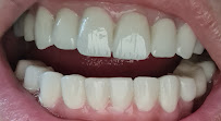 ÖZEL WESTDENT AĞIZ DİŞ HASTANESİ- Türkiye İzmir İmplant Diş Dent Clinic Türkey Dental İmplants in Turkey Zirconium in Turkey