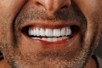 ÖZEL WESTDENT AĞIZ DİŞ HASTANESİ- Türkiye İzmir İmplant Diş Dent Clinic Türkey Dental İmplants in Turkey Zirconium in Turkey