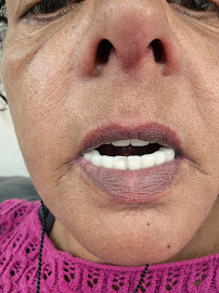 Yeşilyurt Dental - Bozyaka Şubesi | Diş doktoru bozyaka, İmplant İzmir, Zirkonyum İzmir