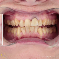 Dentaglobal Ağız Ve Diş Sağlığı Polikliniği