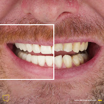 Dentaglobal Ağız Ve Diş Sağlığı Polikliniği