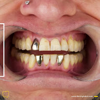 Dentaglobal Ağız Ve Diş Sağlığı Polikliniği