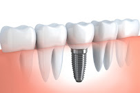 Özel Dent 35 Ağız ve Diş Sağlığı Polikliniği Bornova