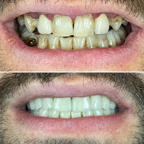 Dentomega İzmir İmplant Diş Polikliniği