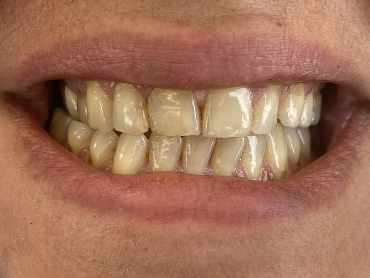 Zahnartz Zmir dental clinic
