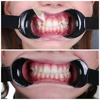 Butik Dental Ortodonti Uzmanı Dr. Yusuf Ozan Topçu Diş Hekimi Dt. Özge Topçu Ortodonti İzmir şeffaf plak tedavi merkezi