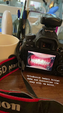 Butik Dental Ortodonti Uzmanı Dr. Yusuf Ozan Topçu Diş Hekimi Dt. Özge Topçu Ortodonti İzmir şeffaf plak tedavi merkezi