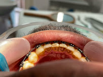 Butik Dental Ortodonti Uzmanı Dr. Yusuf Ozan Topçu Diş Hekimi Dt. Özge Topçu Ortodonti İzmir şeffaf plak tedavi merkezi