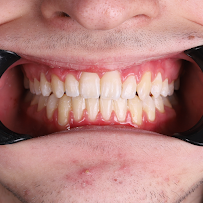 Butik Dental Ortodonti Uzmanı Dr. Yusuf Ozan Topçu Diş Hekimi Dt. Özge Topçu Ortodonti İzmir şeffaf plak tedavi merkezi
