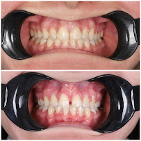 Butik Dental Ortodonti Uzmanı Dr. Yusuf Ozan Topçu Diş Hekimi Dt. Özge Topçu Ortodonti İzmir şeffaf plak tedavi merkezi