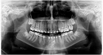 Butik Dental Ortodonti Uzmanı Dr. Yusuf Ozan Topçu Diş Hekimi Dt. Özge Topçu Ortodonti İzmir şeffaf plak tedavi merkezi