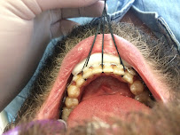 Butik Dental Ortodonti Uzmanı Dr. Yusuf Ozan Topçu Diş Hekimi Dt. Özge Topçu Ortodonti İzmir şeffaf plak tedavi merkezi