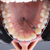 Butik Dental Ortodonti Uzmanı Dr. Yusuf Ozan Topçu Diş Hekimi Dt. Özge Topçu Ortodonti İzmir şeffaf plak tedavi merkezi