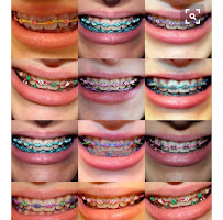 Butik Dental Ortodonti Uzmanı Dr. Yusuf Ozan Topçu Diş Hekimi Dt. Özge Topçu Ortodonti İzmir şeffaf plak tedavi merkezi