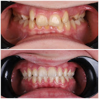 Butik Dental Ortodonti Uzman Dr Yusuf Ozan Topu Di Hekimi Dt. Zge Topu Ortodonti Zmir Effaf Plak Tedavi Merkezi
