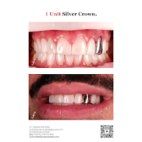 Fidelity Dental Implant & Full Mouth Rehab Bali
