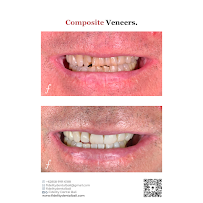 Fidelity Dental Implant & Full Mouth Rehab Bali