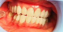 Best Dental Clinic - Dr.N.Deenadayalan in Pondy Bazzar , T Nagar Chennai