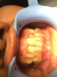 Best Dental Clinic - Dr.N.Deenadayalan in Pondy Bazzar , T Nagar Chennai