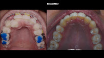 VENKATESWARA LASER DENTAL CLINIC & IMPLANT CENTRE
