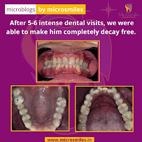 Microsmiles Dental Care