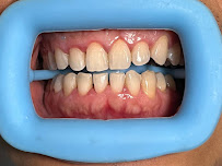 Smile Ready Bali