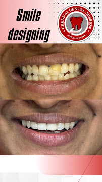 Chennai Dental Mission ( Advanced Implant & Laser foundation)