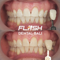FLASH Dental Bali (seminyak)