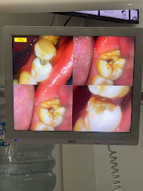 FLASH Dental Bali (seminyak)