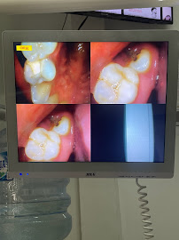 FLASH Dental Bali (seminyak)