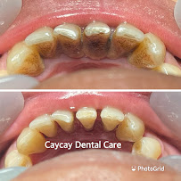 FLASH Dental Bali (seminyak)