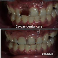FLASH Dental Bali (seminyak)