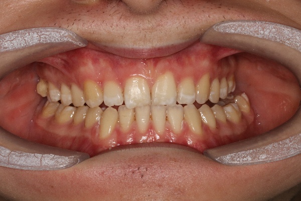 Chennai Orthodontics dental clinic