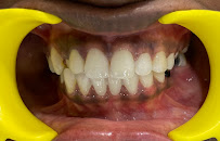 Dr.Thiagu’s Dental Clinic & Orthodontic centre,Invisalign centre,Root canal, Implants,Braces,Best dental clinic in T.Nagar