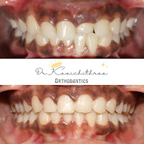 Dr.Kavi's Orthodontic and Dental Center | Dental Clinic | Braces & Invisalign Provider