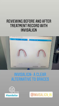 Smile Corner Dental Clinic | Center for Braces and Invisalign
