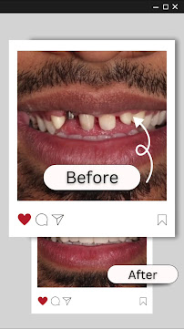 Dr. Preethi Udhayaraja Dental and Aesthetics - Invisalign Centre
