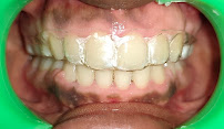 Dr. Pradeep's Dental Hub Orthodontic & Implant center