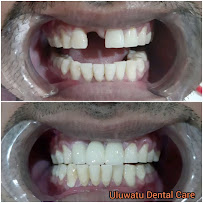 Uluwatu Dental Care