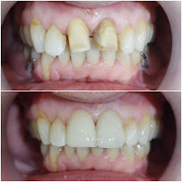 Uluwatu Dental Care