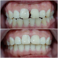 Uluwatu Dental Care